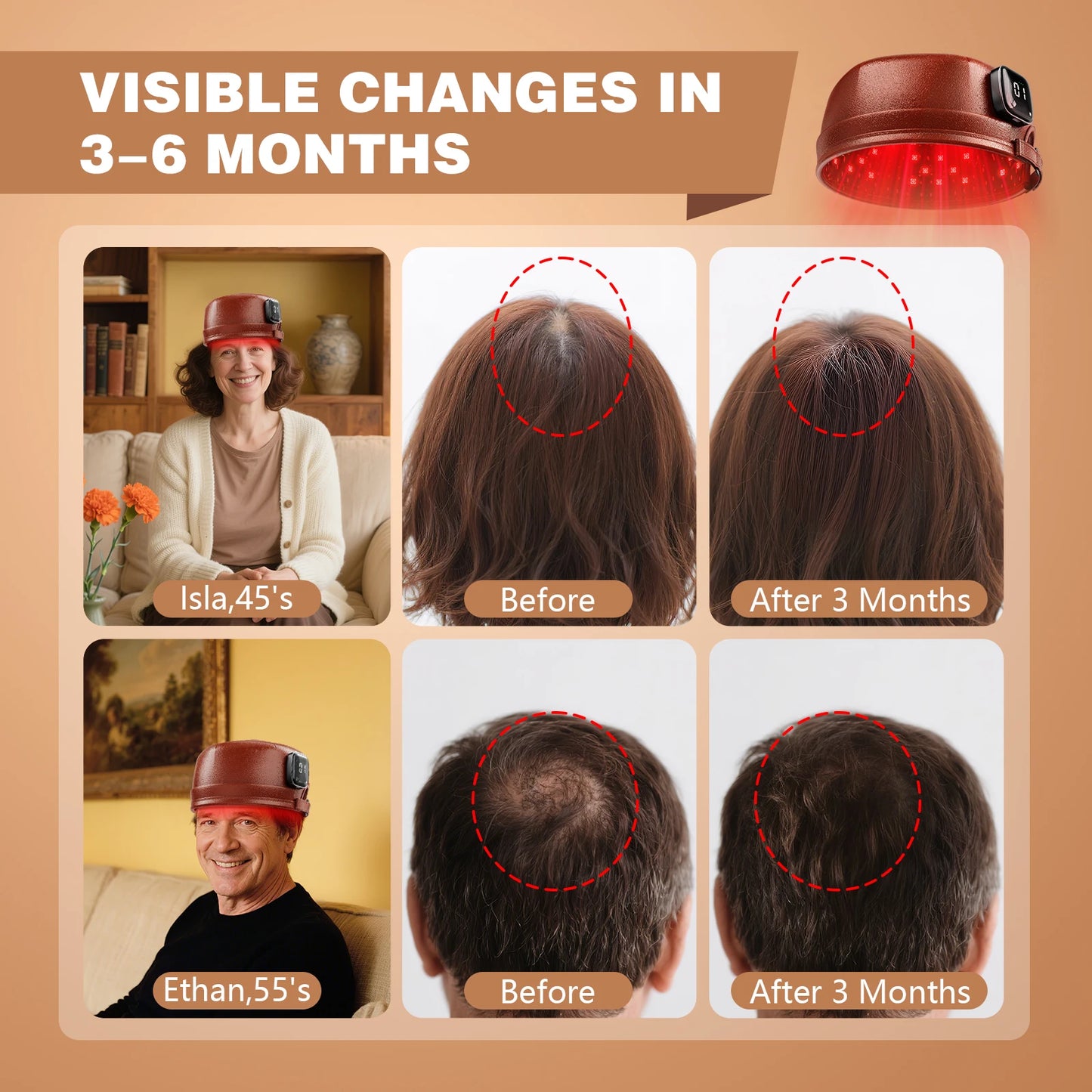 Laser Hair Growth Cap 660nm&850nm Red Light Therapy Cap 3000mAh for Hair Regrowth Anti Hair Loss Relax Scalp Hair Care Hat