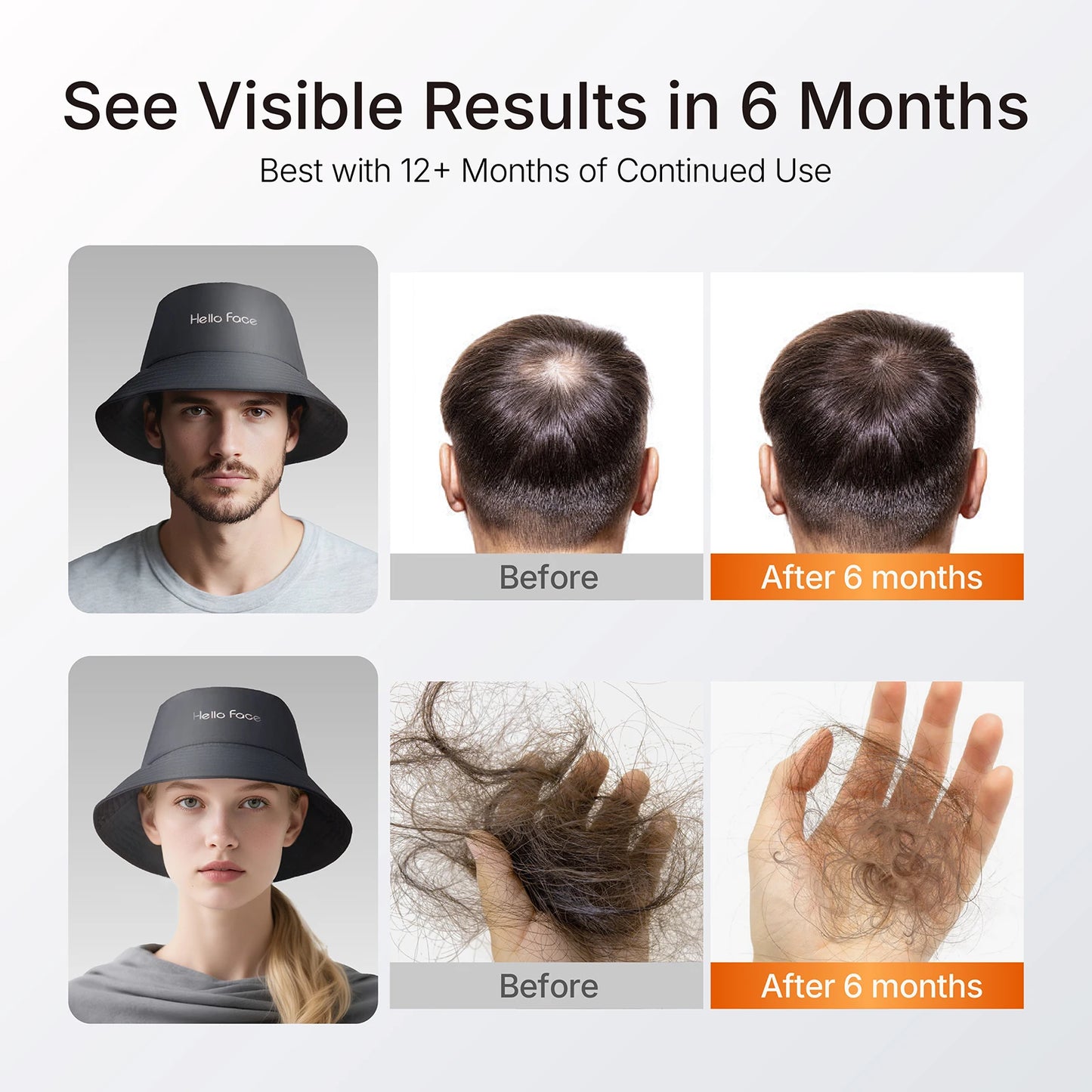 Hello Face T100 Red Light Therapy Hair Growth Cap Promote Hair growth in women and men New Bucket Hat