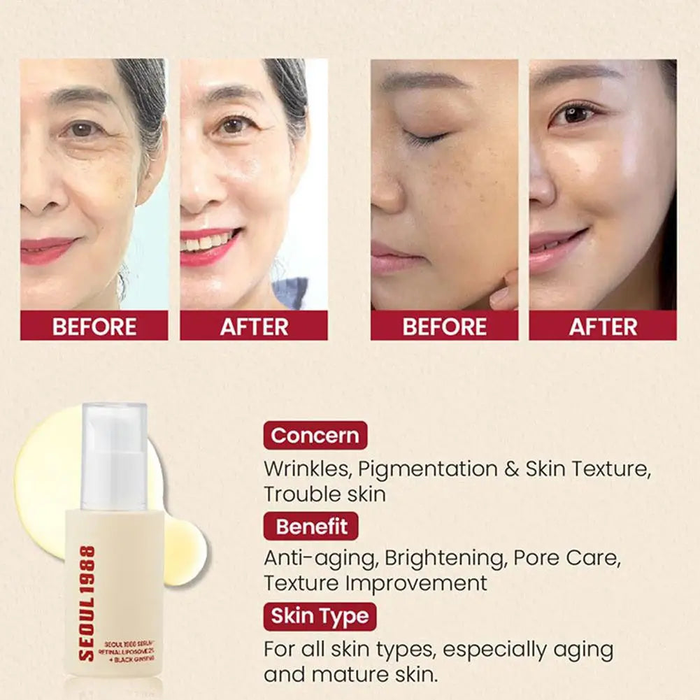 Korean SEOUL 1988 Moisturizing Serum Niacinamide Sunscreen Snail Cream Black Gingeng Extract Glow Face Serum Improve Skin Care