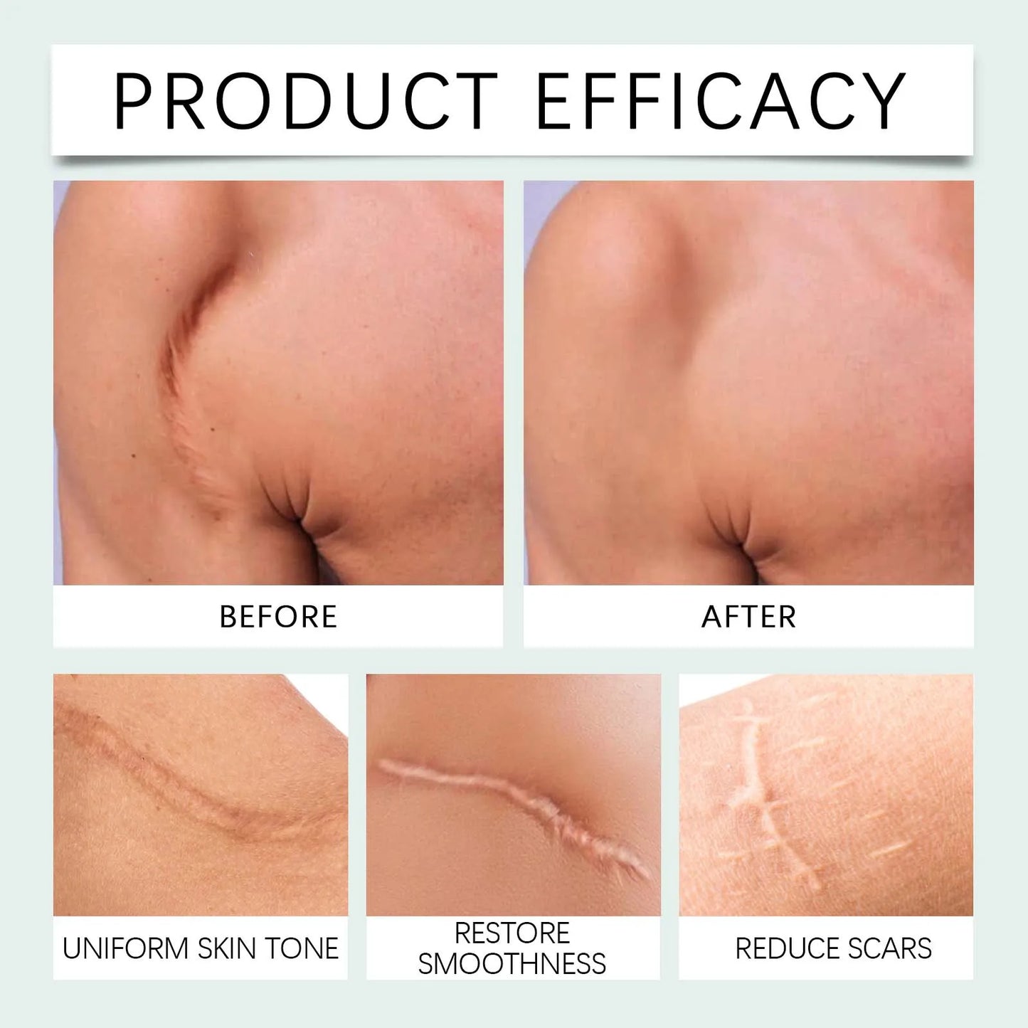 Silicone Skin Scar Care Patch Smooth Skin Gentle and Skin-Friendly Reduces Fine Lines and Wrinkles Nourishing Skin Care Patch