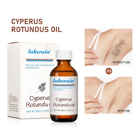 60ml Cyperus Rotundus Oil Nourish the Skin Ingredients are Safe Inhibit Hair Growth Wide Scope of Application Solve Hair Dense P
