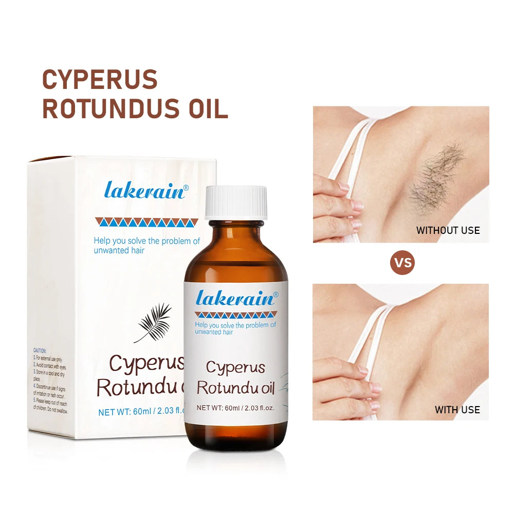 Inhibit Hair Growth 60ml Cyperus Rotundus Oil Nourish the Skin Ingredients are Safe Wide Scope of Application Solve Hair Dense