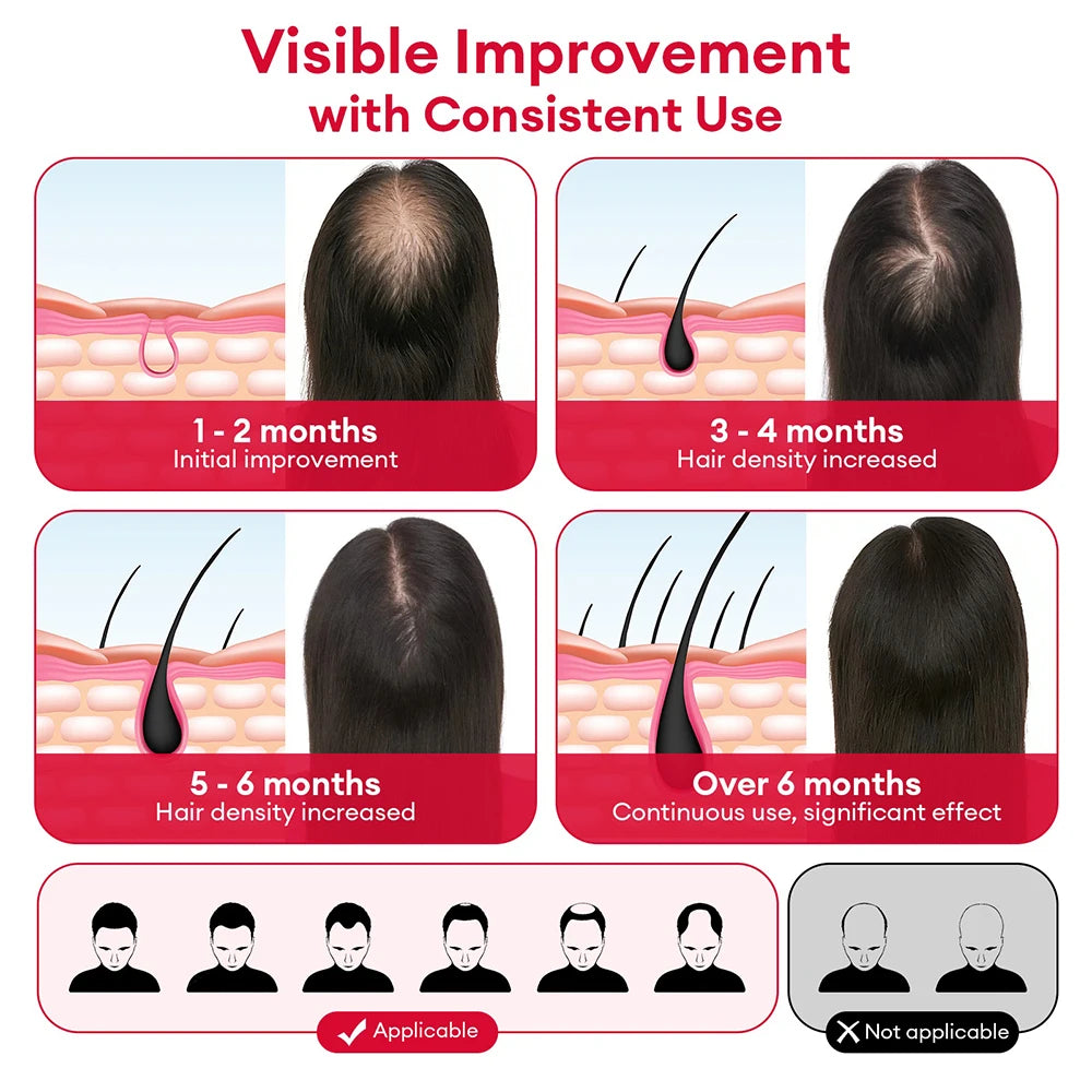 650nm+850nm Red Light Infrared Hair Growth Cap Hair Loss Treatment Hat Hair Regrowth Care Anti Hair Loss Restore Hair Thickness