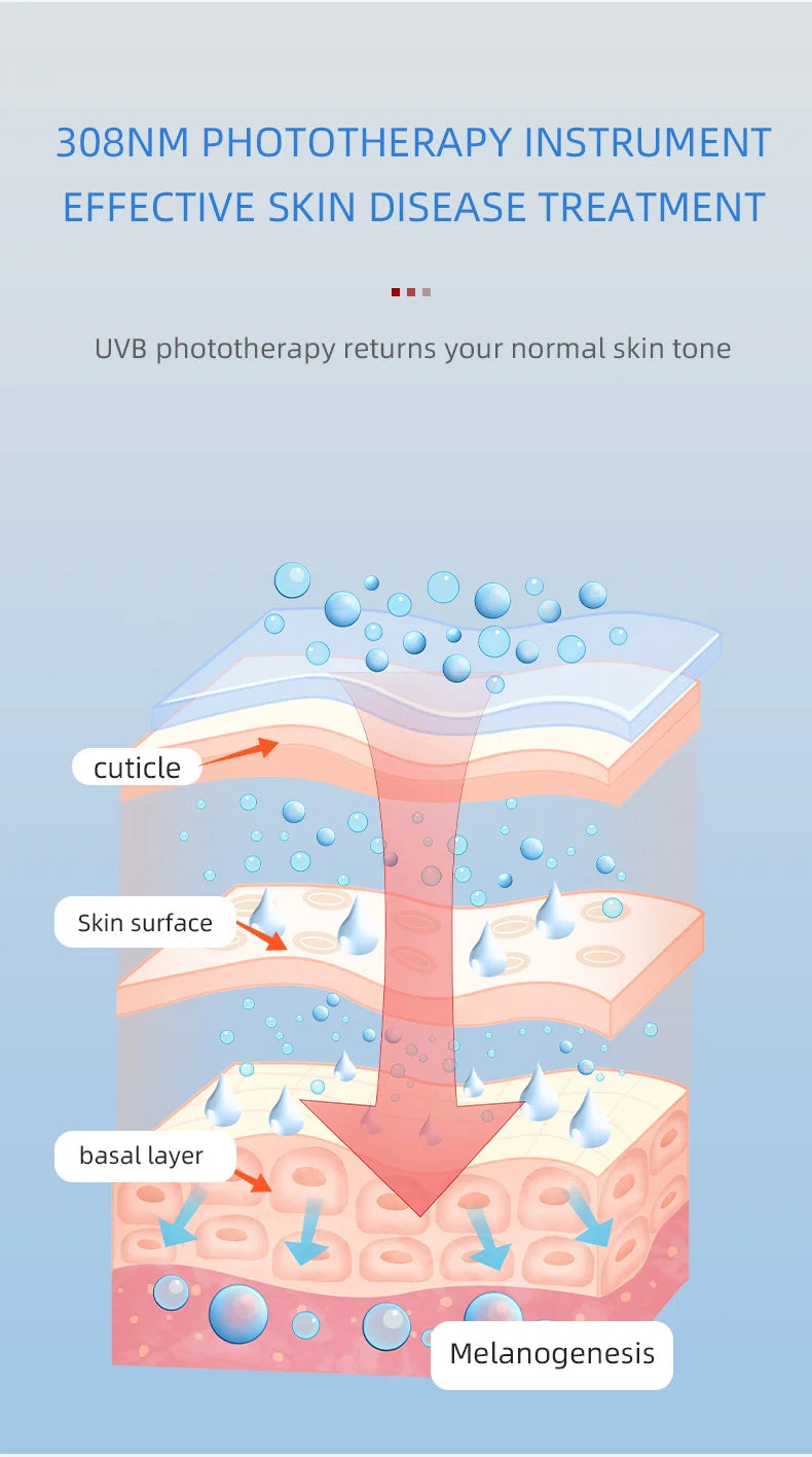 Uvb Lamp Vitiligo Physical Therapy Equipment Narrowband Light Lamp Medical Light Source UV 311nm Therapy For Psoriasis Eczema