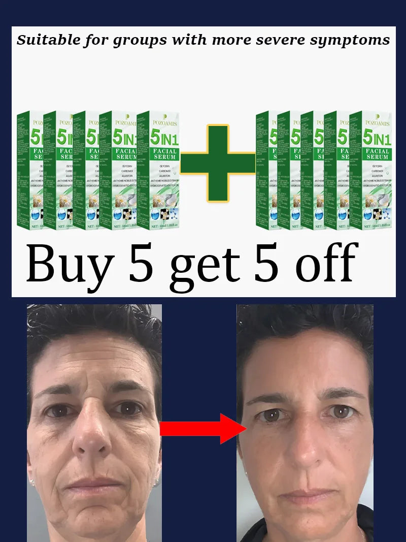 Daily Skincare Products Quͧiͥcͨᴋⷦly rReͤdͩuͧcͨeͤ Wrͬiͥnᴋⷦleͤs͛