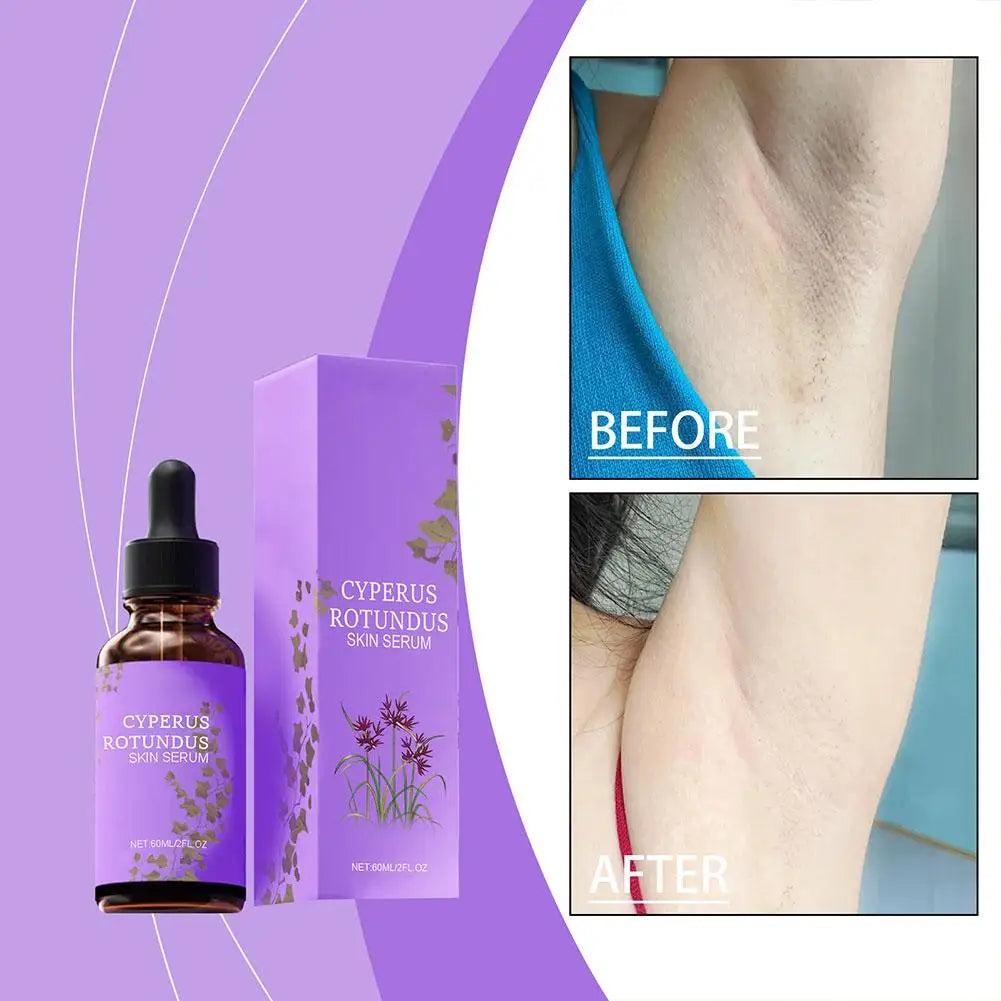 OceAura Cyperus Rotundus Oil for Hair Removal Prevent Hair Growth Products Remove Hair Inhibitor for Moisturizing Body Oil 60ml