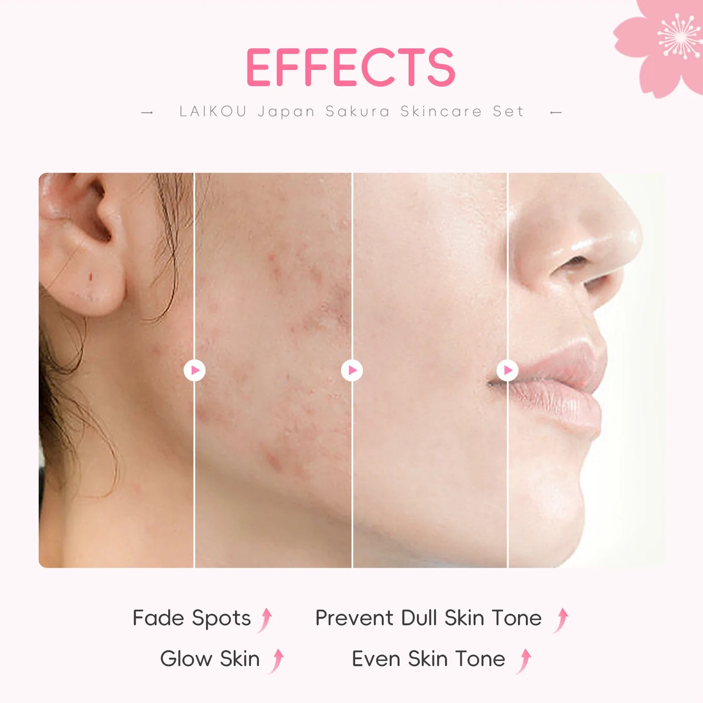 Japan Sakura Skincare Set 4pcs Hydrating Tightening Cleanser Serum Essence Cream Eye Treatment Soften Clean Skin Beauty