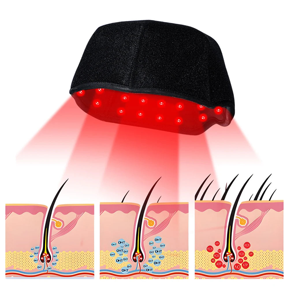 300Pcs Beams hair growth cap 650nm 850nm Red light Near Infrared 100pcs LED Light Hat Anti Hair Loss Relax scalp Massager Device