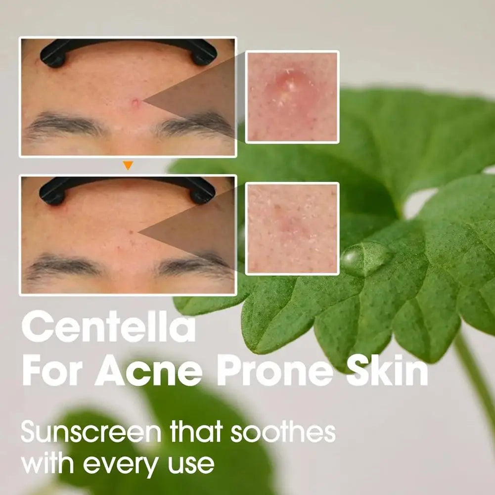 SOME BY MI AHA BHA PHA 30 Days Miracle Skin Care Lotion Face Cream and Cleanser Made from Tea Tree Leaf Water for Sensitive Skin