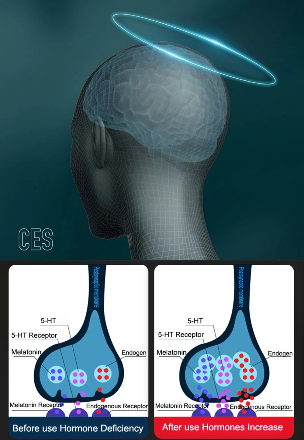 Sleep Aid Device CES Stimulation Therapy 1600mAh Rechargeable Ear Clip Type Relieve Anxiety Mitigation Fast Sleep Instrument