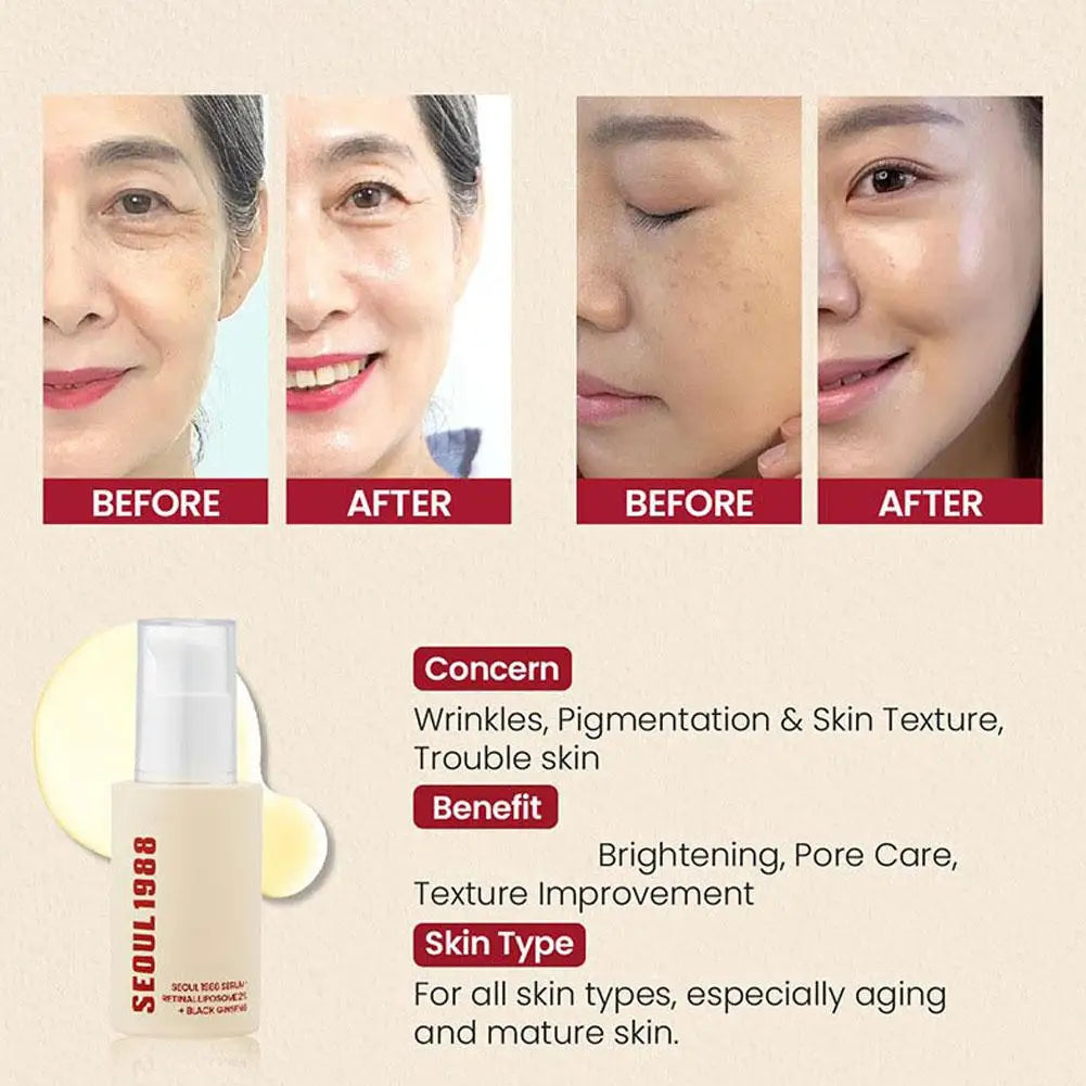 Seoul 1988 Moisturizing Eye Cream Niacinamide Retinoic Acid Ginseng Essence Firm Cream Lighten Fine Lines Deep Care Essence Set