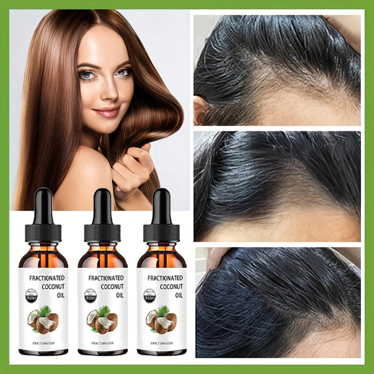 Fractionated Coconut Oil 100% pure coconut can moisturize, soften and care for dry and cracked skin,