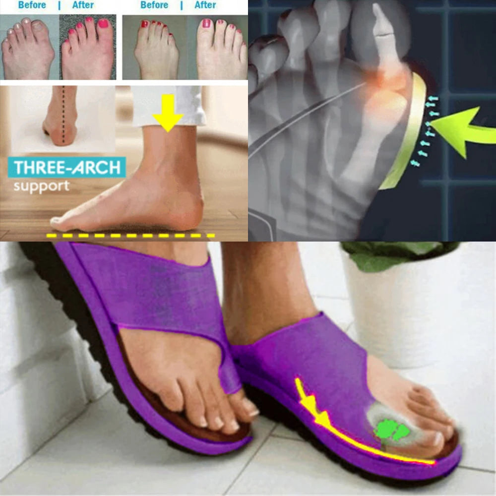 Women Summer Sandals Comfy Platform Flat Shoes Sole Ladies Casual Soft Big Toe Foot Sandal Orthopedic Bunion Corrector Slippers