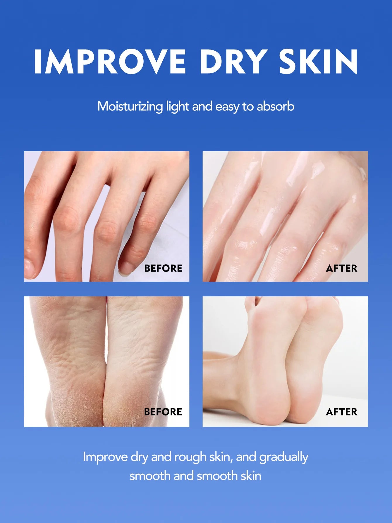 Ultra-Nourishing Squalane Cream for Dry Rough Skin Deeply Moisturizing Prevents Cracking Dryness Hypoallergenic Hand Foot Cream