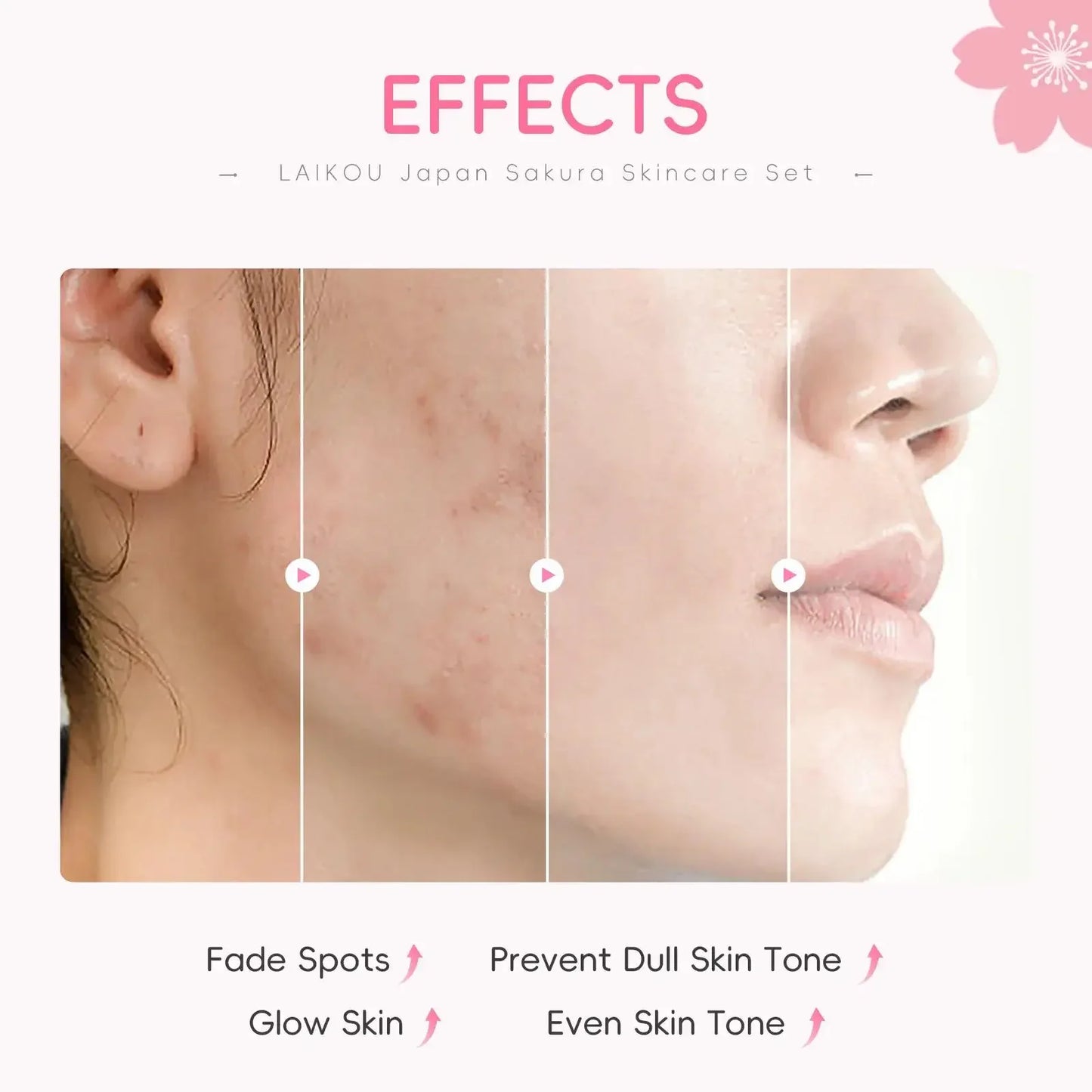 Japan Sakura Skincare Set 4pcs Hydrating Tightening Cleanser Serum Essence Cream Eye Treatment Soften Clean Skin Beauty