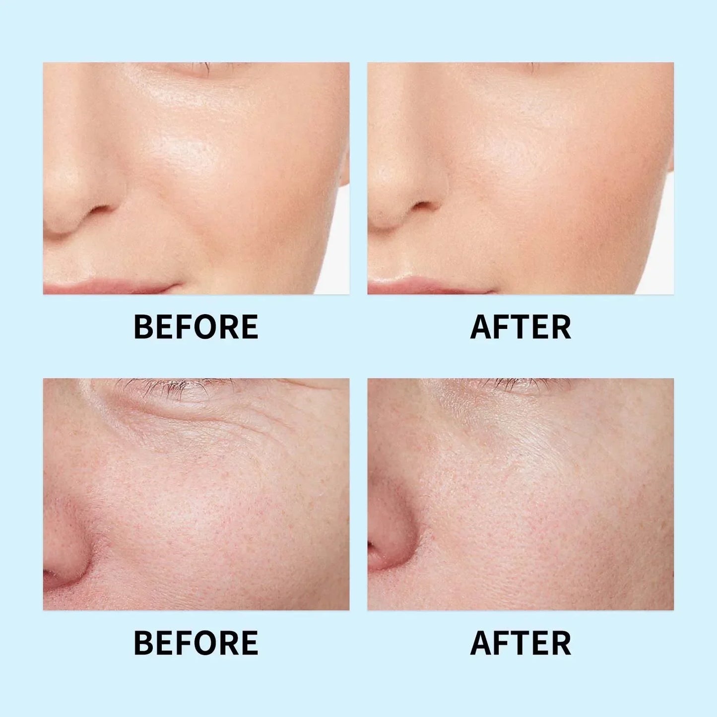 Skin Care Hyaluronic Acid Liquid Serum Facial Moisturizing Lifting Glow Up Facial Essence Quick Absorption Dermapen Serum