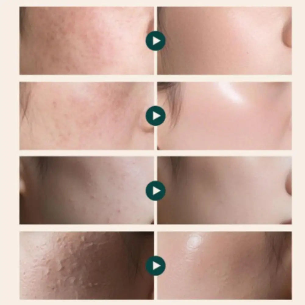 Korean Dr. REJUALL Rejuvenating Cream Deep moisturizing Lightening Facial Lifting Firming Oil Control Anti-acne  Skin Care