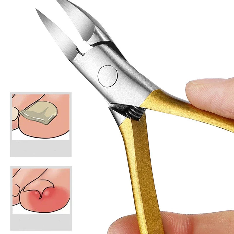 Nail Clippers Ingrown Toenail Scissors Podiatry Correction Nippers Cuticle Cutters Cut Paronychia Pedicure Foot Care Tool