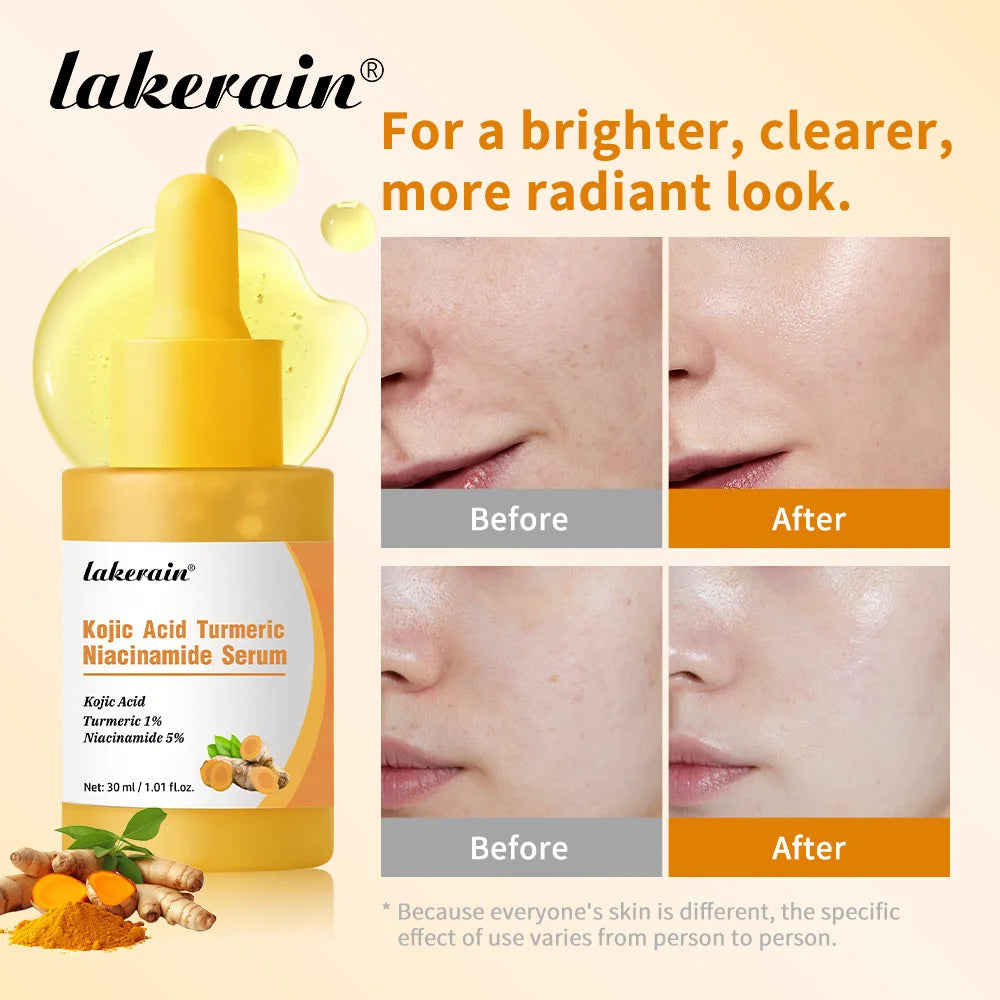 Kojic Acid Turmeric Niacinamide Serum Brighten Skin Tone Soothe Skin Deep Moisturizing Precise Dropper Design Facial Care