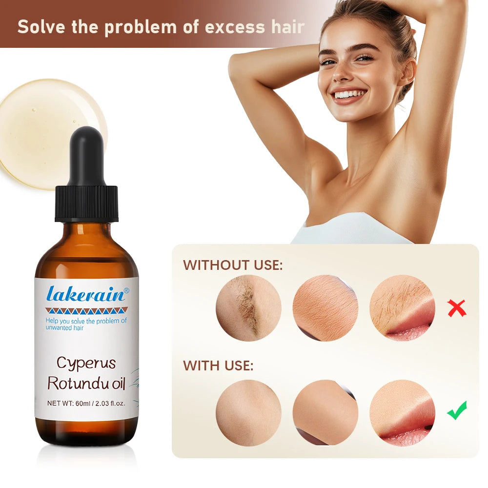 60ml Cyperus Rotundus Oil Nourish the Skin Ingredients are Safe Inhibit Hair Growth Wide Scope of Application Solve Hair Dense P