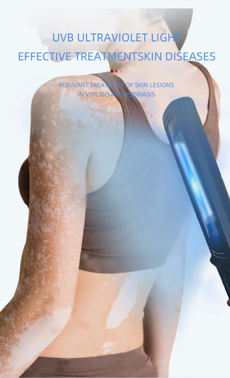 Uvb Lamp Vitiligo Physical Therapy Equipment Narrowband Light Lamp Medical Light Source UV 311nm Therapy For Psoriasis Eczema