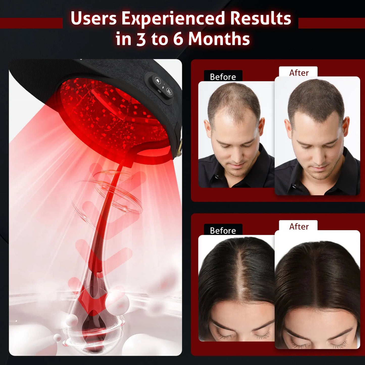 Hair Growth Laser Cap 660nm 850nm Red Light Therapy Hat for Men Women Hair Regrowth System Treatment Device Anti Hair Loss