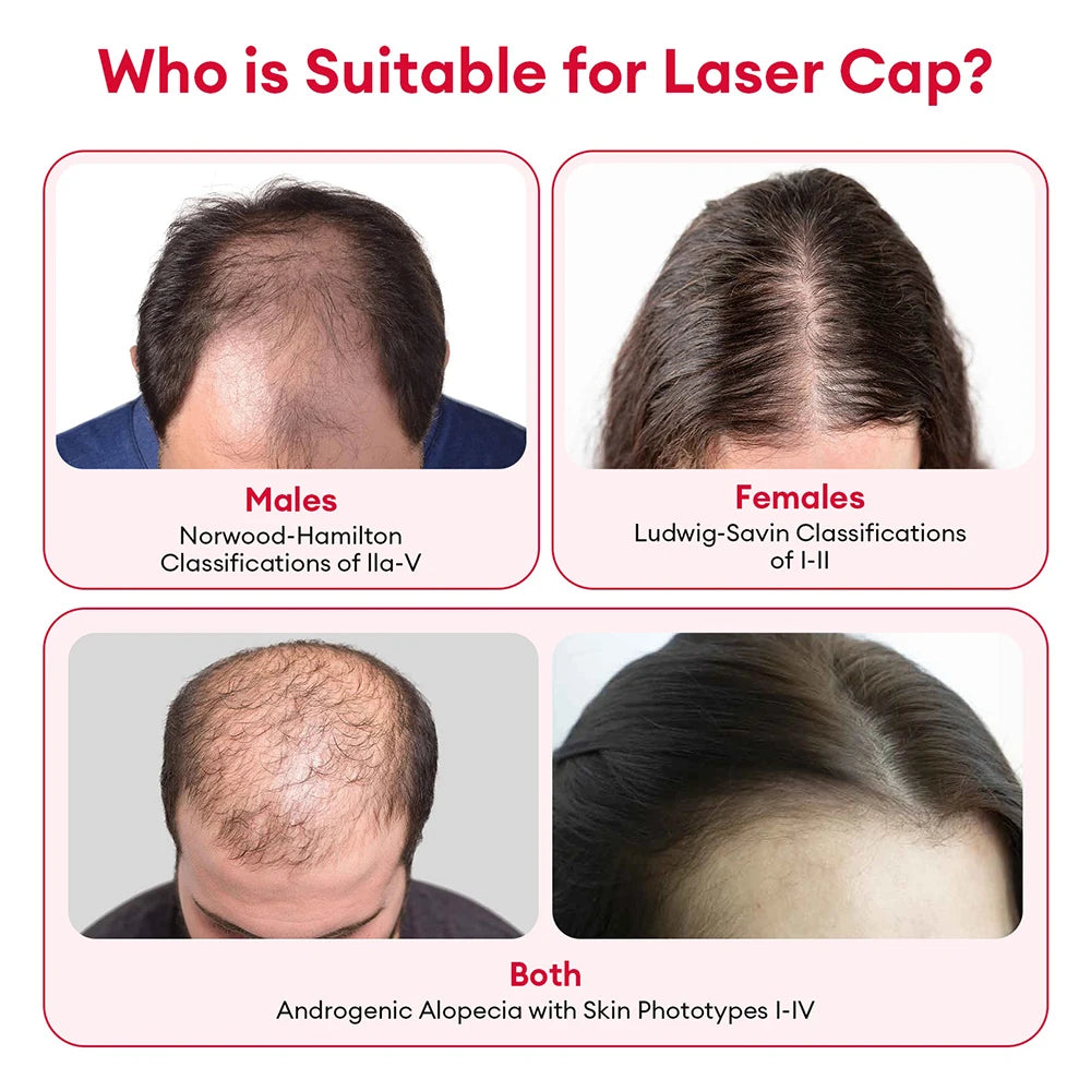 650nm+850nm Red Light Infrared Hair Growth Cap Hair Loss Treatment Hat Hair Regrowth Care Anti Hair Loss Restore Hair Thickness