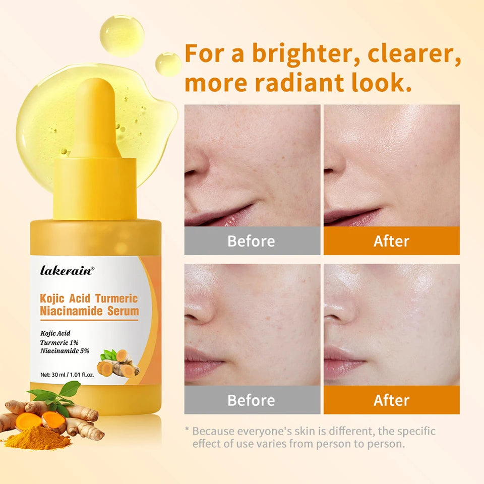 Kojic Acid Turmeric Niacinamide Serum Brighten Skin Tone Soothe Skin Deep Moisturizing Precise Dropper Design Facial Care