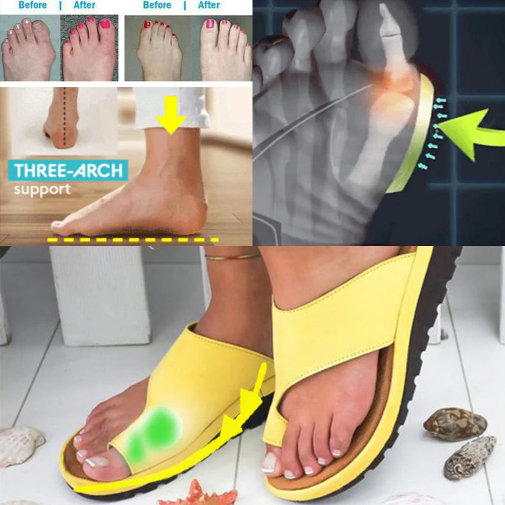 Women Summer Sandals Comfy Platform Flat Shoes Sole Ladies Casual Soft Big Toe Foot Sandal Orthopedic Bunion Corrector Slippers